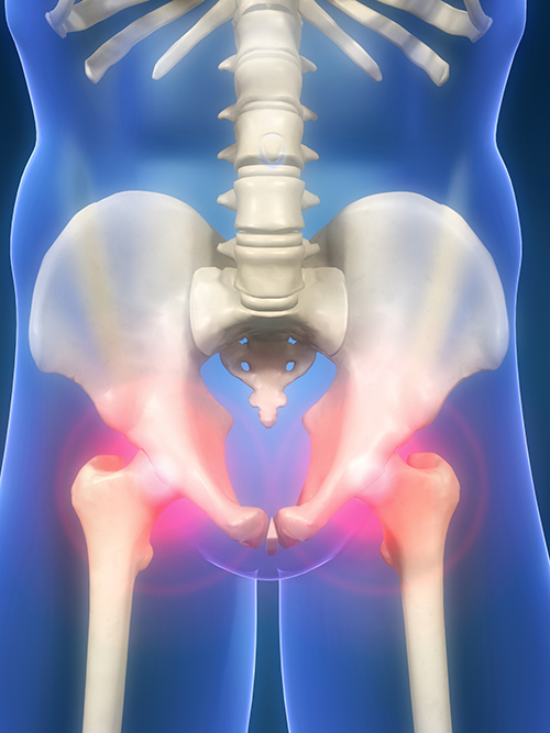 Specialize in Diagnosing and Treating Hip Pain at Nevada Orthopedics in Reno NV